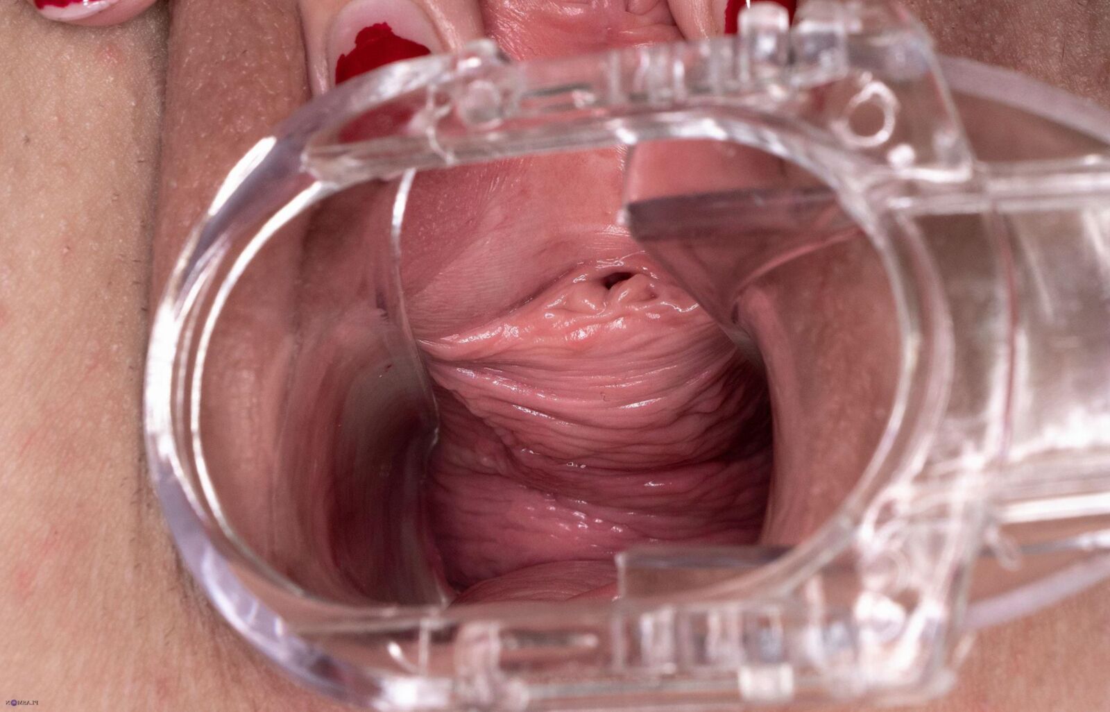 Gaping 