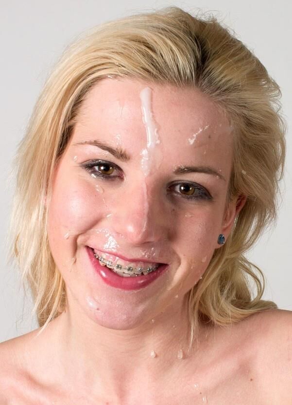 Girls with braces!