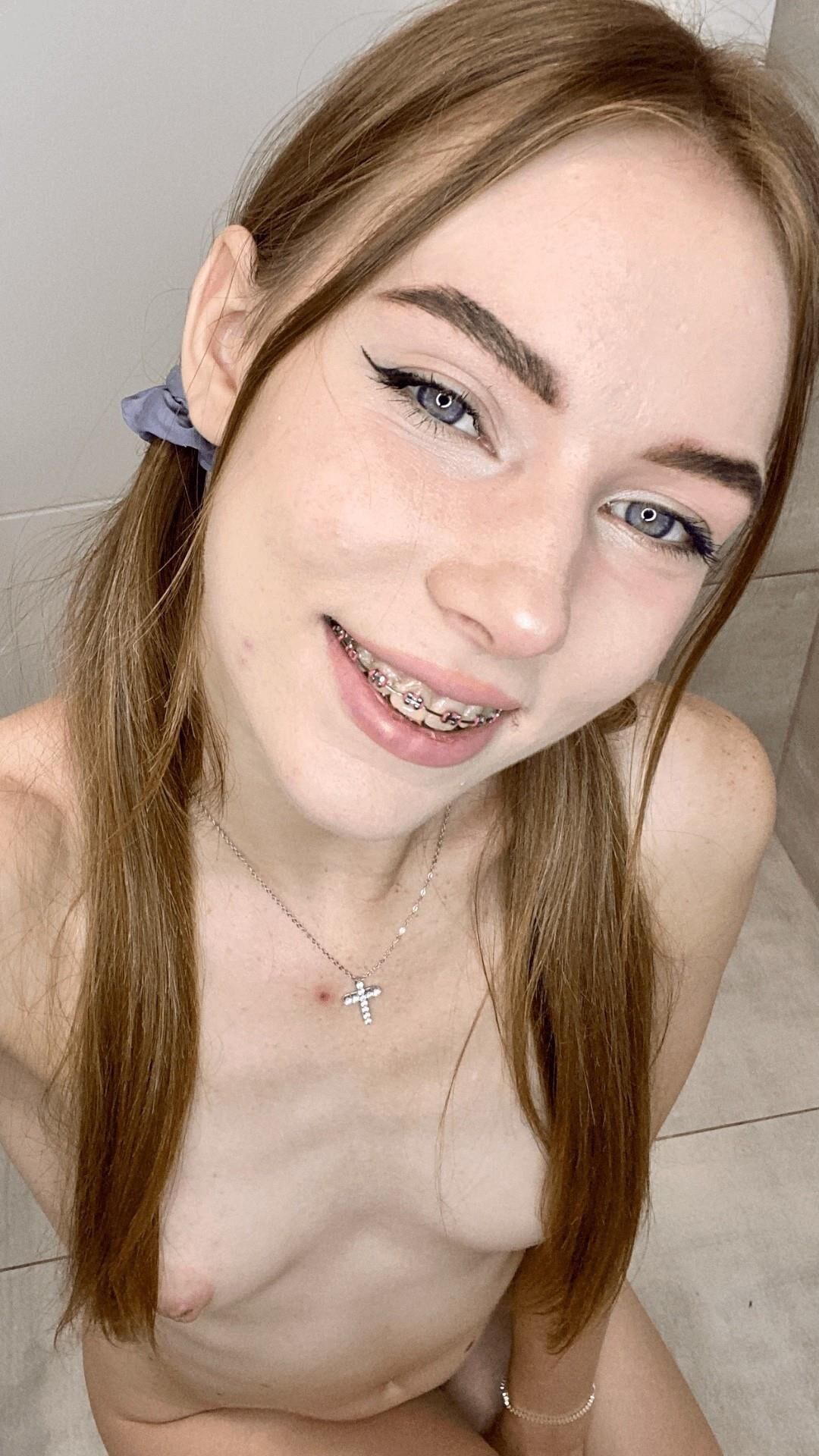 Girls with braces!