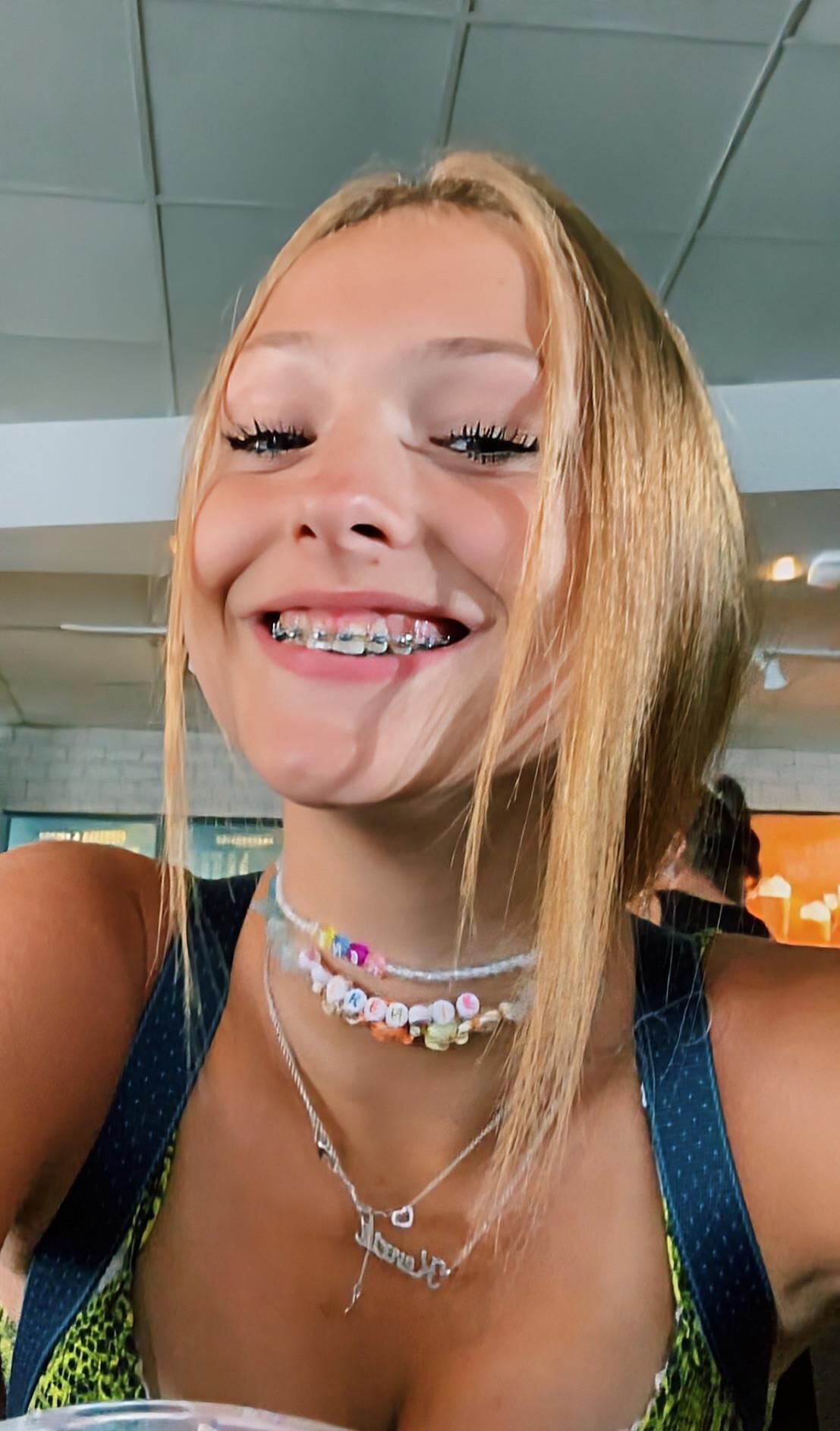 Girls with braces!