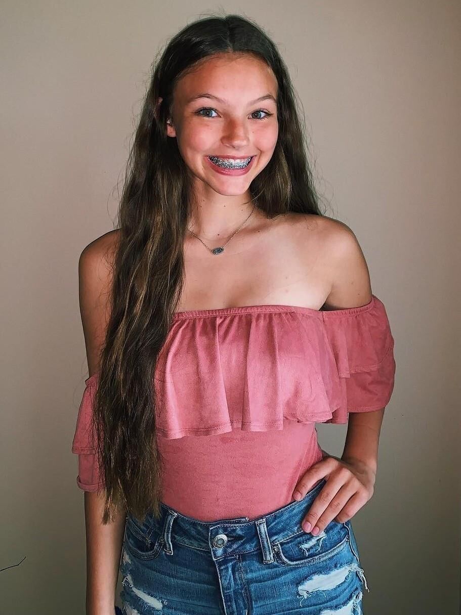 Girls with braces!