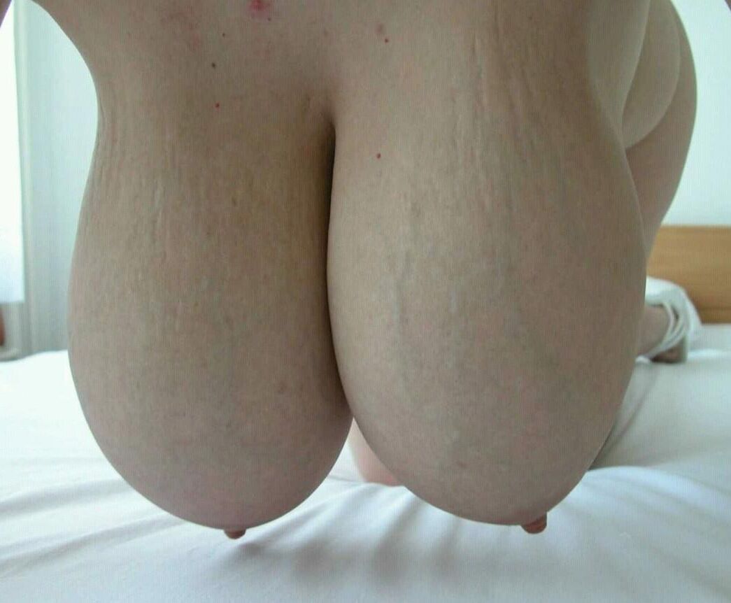 Tetas