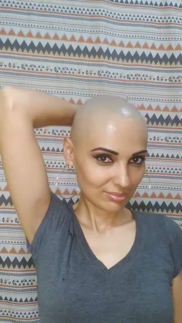Bald cunts