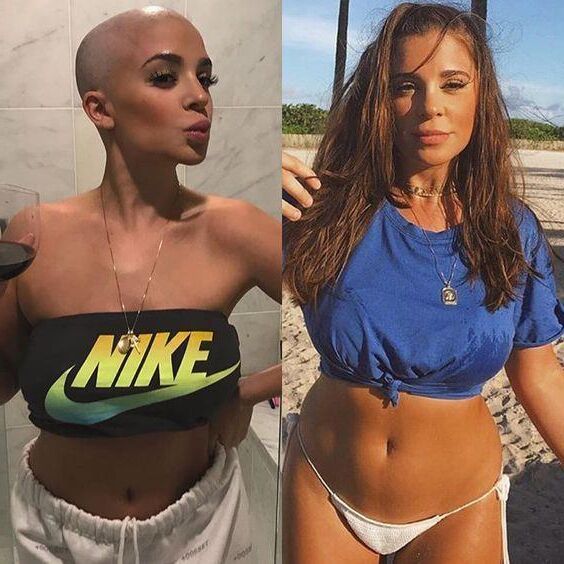 Bald cunts